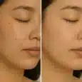 Vitamin c serum Benifits