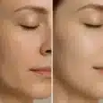 Hyaluronic Acid Serum